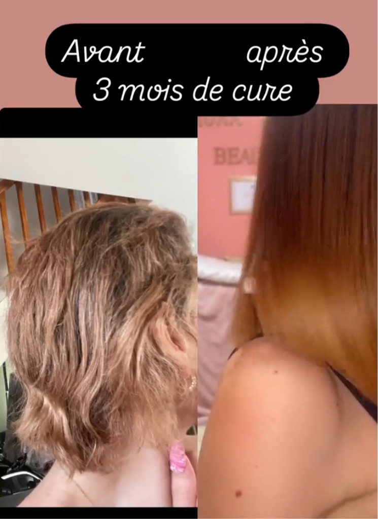 Gummies pousses des cheveux, ongles & beauté cure de 3 mois 3 boîtes